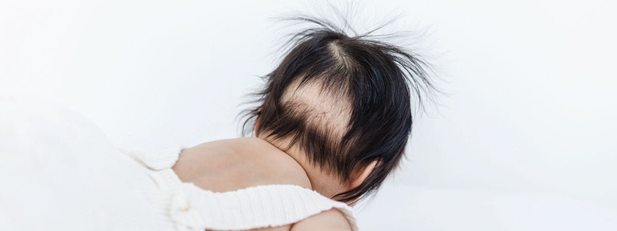 Baby Hair Loss & Bald Spots: 5 Ways To Prevent It & Encourage Hair Growth