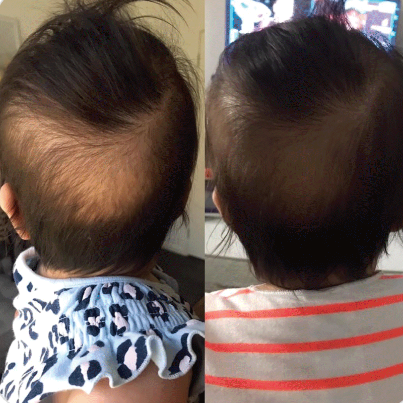Silky Tots